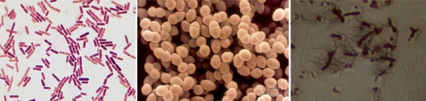 Το E. coli, ο εντερκόκοκκος κοπράνων και ο πρωτεός είναι οι κύριοι αιτιολογικοί παράγοντες της χρόνιας βακτηριακής προστατίτιδας